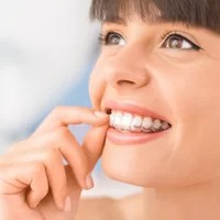 Invisalign 1