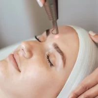 Laser Treatment For Skin Whitening