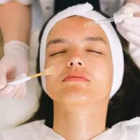 Peels