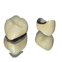 Porcelain Fused to Metal Crown