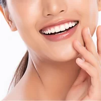 Tooth Colored Dental Fillings 3 1
