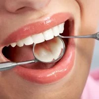 Tooth Filling