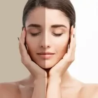 skin-lightening